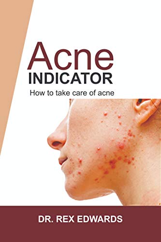 THE ACNE INDICATOR: HOW TO TAKE CARE OF ACNE