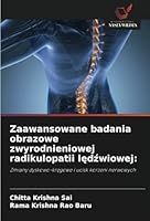 Zaawansowane badania obrazowe zwyrodnieniowej radikulopatii ledzwiowej:: Zmiany dyskowo-kregowe i ucisk korzeni nerwowych (Polish Edition) 6208657385 Book Cover