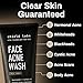 Acne System for Men and Boys, Face Wash, Moisturizer, Pimple Patches, Shield Men's Skin Care Set (2 Months)