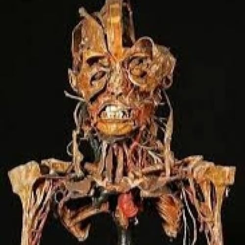 Honoré Fragonard, anatomía revolucionaria. Podcast Por arte de portada