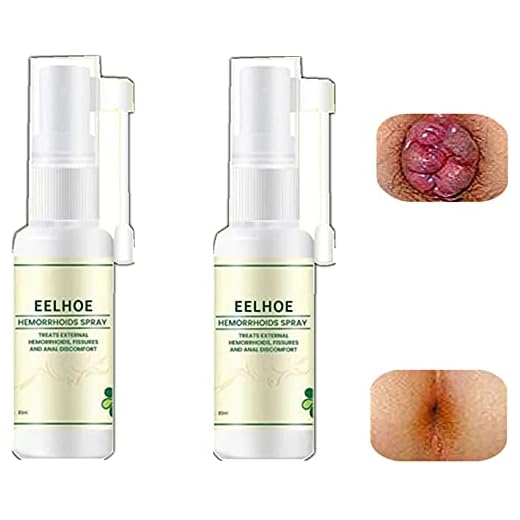 Naturliga växtbaserade hemorrojder spray, snabb lindring av hemorrojder och analfissurer, 100% naturlig formel, lugnande lindring, lugnar klåda brännande, mild, fungerar snabbt 30 ml
