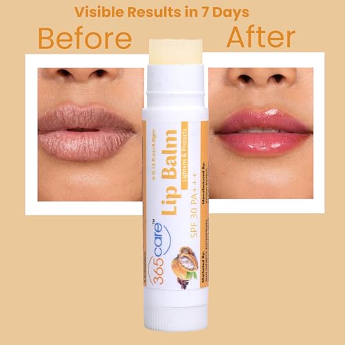 Image of SPF 30 Lip Balm for Dark Lips Lightening & Pigmentation | Cocoa Butter Lip Balm for Smokers, Dry & Chapped Lips | 24hr Deep Moisturizing & Sun Protection PA+++ for Men & Women - 4.8g