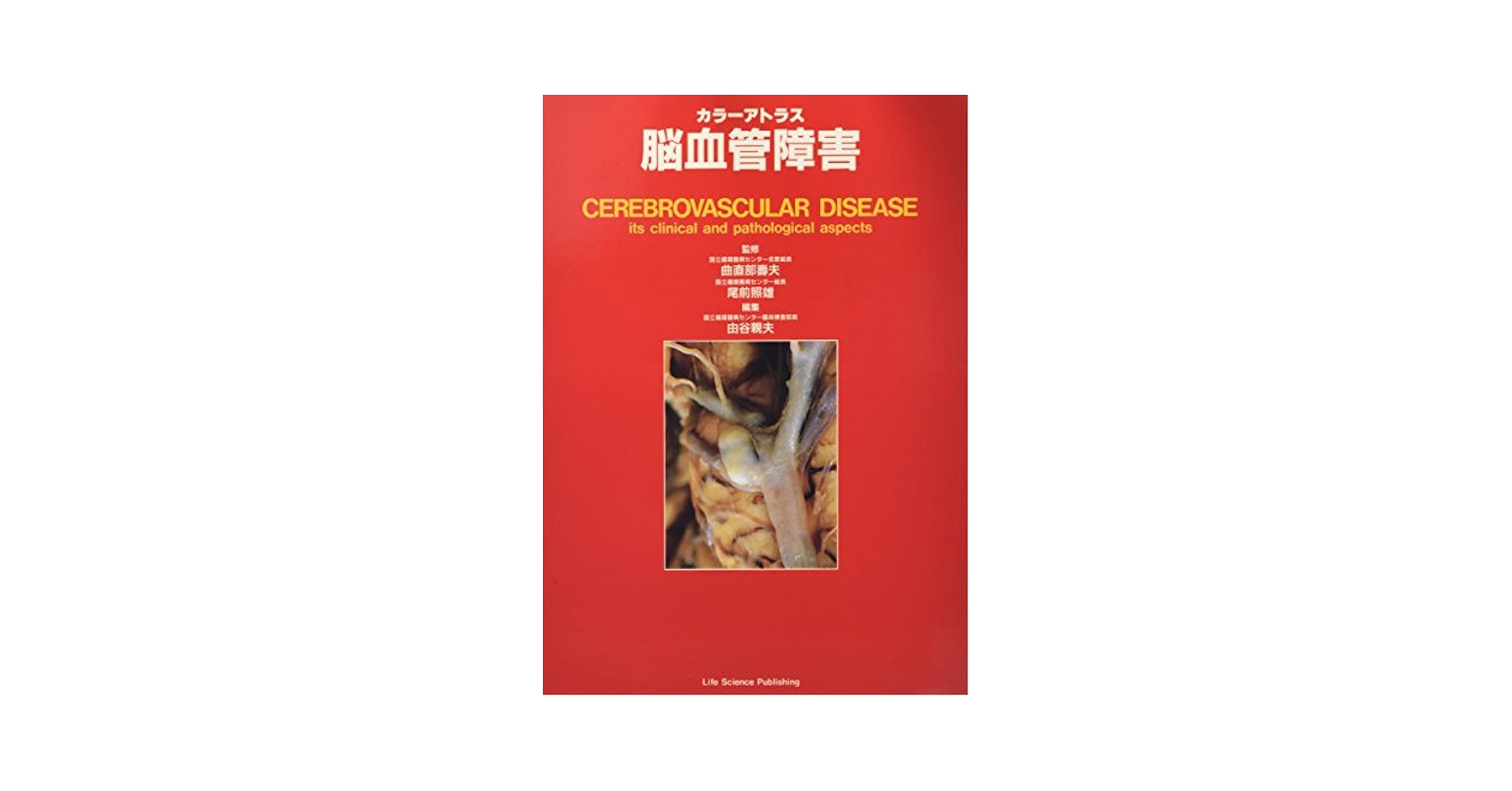 カラ-アトラス血管疾患 ｉｔｓ　ｃｌｉｎｉｃａｌ　ａｎｄ　ｐａｔｈｏｌｏｇ/ライフサイエンス出版/北村惣一郎（大型本） カラーアトラス血管疾患 : its clinical and patholog… 本