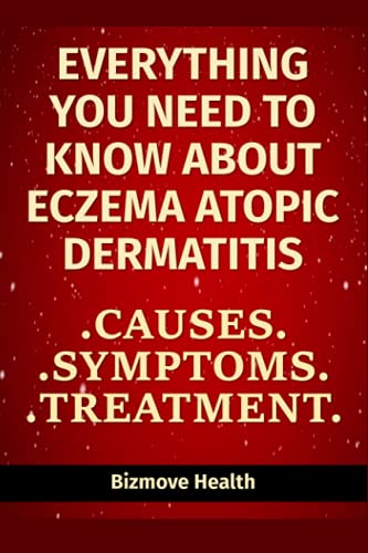 Everything you need to know about Eczema - Atopic Dermatitis: Causes, Symptoms, Treatment
