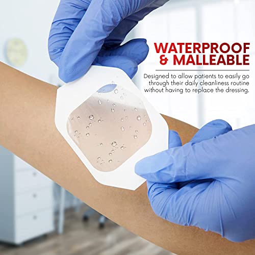 image for Transparent Film Dressing, 4