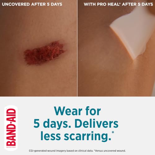 Image of BAND-AID Brand Pro Heal 5 Day Protect Hydrocolloid Bandages, Assorted, 14ct