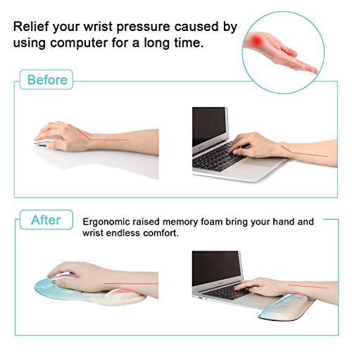 image for Anyshock Keyboard Wrist Rest and Ergonomic Mouse Pad with Wrist Suppor