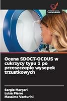 Ocena SDOCT-OCDUS w cukrzycy typu 1 po przeszczepie wysepek trzustkowych (Polish Edition) 6209026052 Book Cover