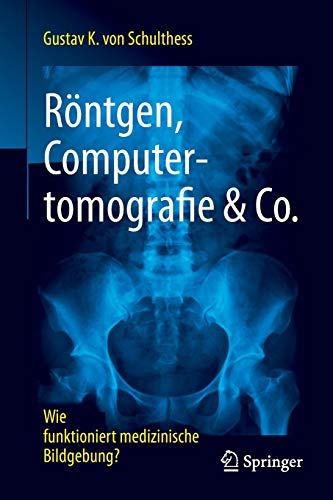 Röntgen, Computertomografie & Co.: Wie funktioniert medizinische Bildgebung? Röntgen, Computertomografie & Co.: Wie funktioniert medizinische Bildgebung?