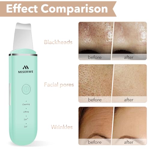 Skin Scrubber Face Skin Spatula Facial Scrubber Spatula for Deep Cleansing Blackhead Remover Pore Cleaner with 4 Modes - Image 6