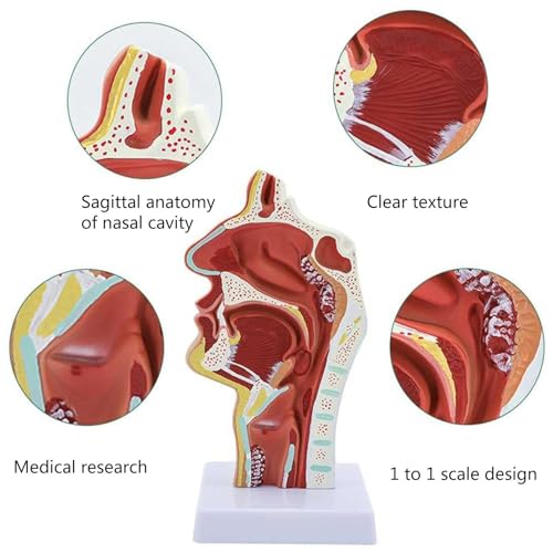 Modèle de pathologie ENT de taille réelle AMITD avec polypes et amygdalite - 4