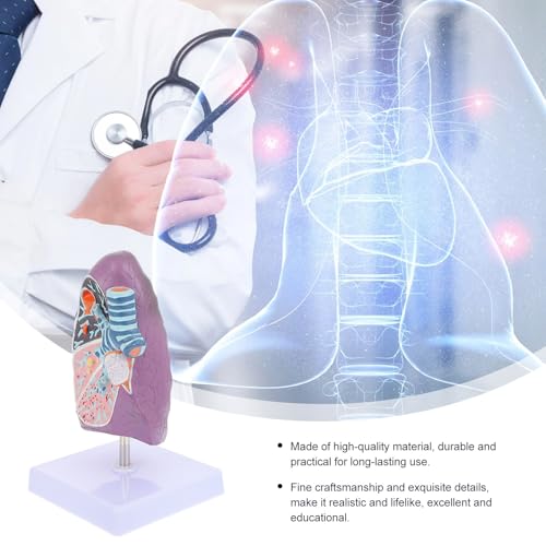 Modèle pulmonaire pathologique réaliste en plastique pour anatomie - 3