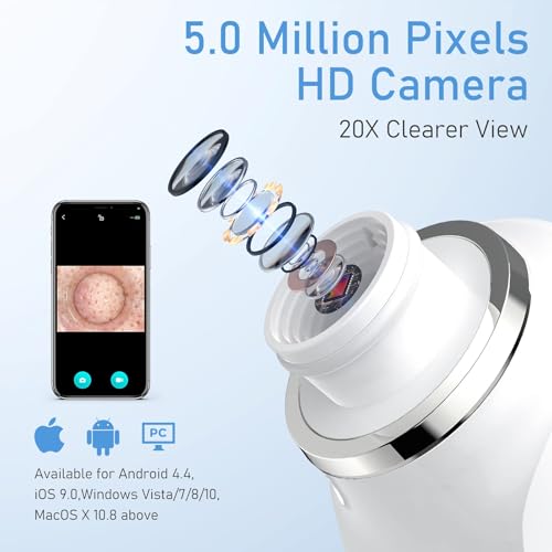 Image of HD Camera USB Blackhead Remover, 3 Modes 6 Heads for Men Women | 20x magnified cleaning, APP WiFi connection, adjustable vacuum suction, effective blackhead removal, one-month long standby