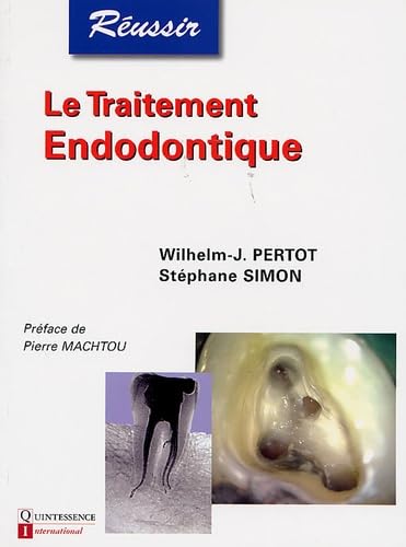Le traitement endodontique
