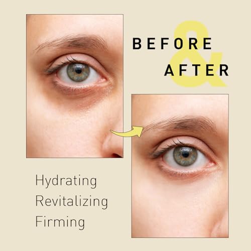 image for Enaskin Naturals Under Eye Patches for Dark Circles: Snail Mucin Gel M