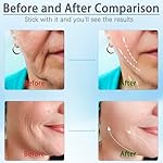 JURP Face and Neck Massager, 3 Color Led Face Neck Massager, Multifunctional Facial Skin Care Tool, Ideal for Home Skin Care - Image 5