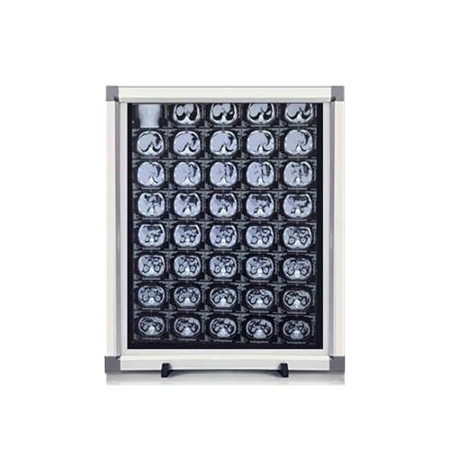 X Ray LED Illuminator, X-Ray Viewer Film Illuminator Light Box, Acrylic Panel & Aluminum Frame, Adjustable Brightness, Flicker-Free, for Clinic and Hospital, Lab Equipment(16x19x0.3in/41x47.5x1cm)