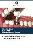 Crestal-Knochen und Zahnimplantate: DE
