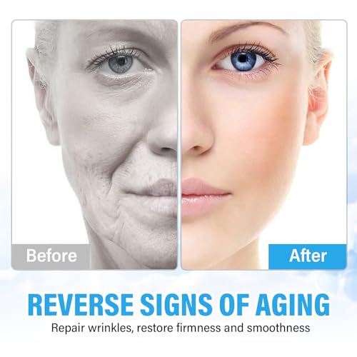 Stem Cell Anti-Aging Serum - Firm, Hydrate, and Renew Your Skin for a Youthful Glow,Strengthens and Moisturises Skin，Use with and Without MicroNeedling, Anti Aging & Smooth Wrinkles