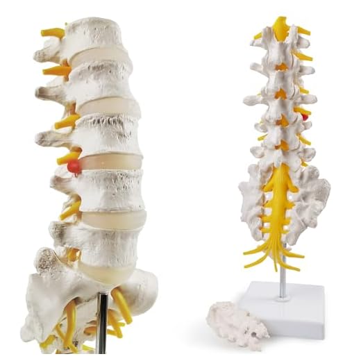 Detailed Life Size Lumbar Spine Model