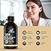 artnaturals USDA Organic Jojoba Oil - (2 Fl Oz / 60ml) - 100% Pure Golden Cold Pressed Carrier Oil - Sensitive Skin, Face Hair, Nails and Cuticle - Dry Scalp Blemish and Acne Treatment