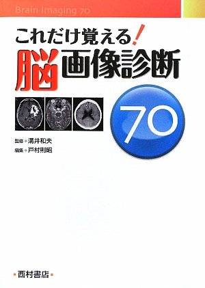 無料電子書籍アプリ これだけ覚える!脳画像診断70 バイ