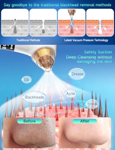 Image of Upgraded Visible Blackhead Remover Pore Vacuum,5 Suction Levels,6 Probes | Heating Facial Deep Cleansing,6MP HD Camera,25X Magnification Facial Pore Acne,Comedone Whitehead Extractor Tools Women Men