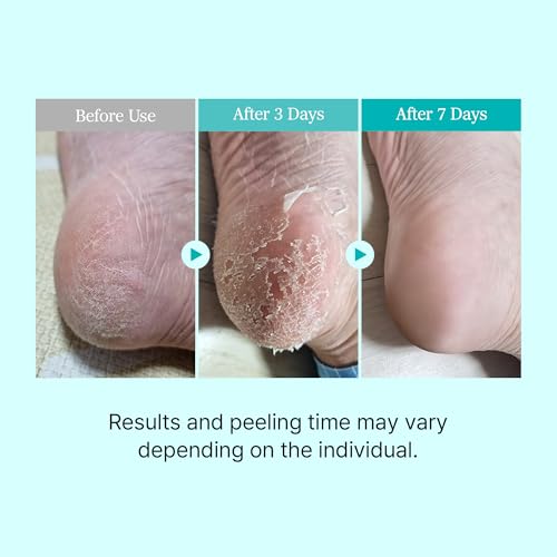 Image of Ariul Smooth & Pure Foot Peeling Mask (1 Pair) Korean Exfoliating Soothing Foot Mask Socks for Dead Skin & Callus Removal, AHA BHA Foot Peel Treatment for Dry Cracked Feet, Soft Smooth Foot Care Mask (Aloe Vera)