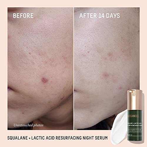 Thumbnail image for BIOSSANCE Squalane + Lactic Acid Resurfacing Night Serum