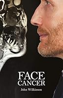 Face Cancer 1999919653 Book Cover