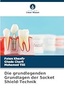 Die grundlegenden Grundlagen der Socket Shield-Technik 6209282768 Book Cover