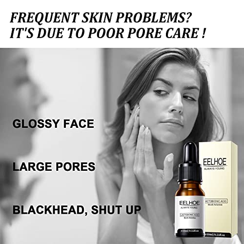 Astideer Belay Serum For The Face, Belay Always Young Lactobionic Acid Zero Pore Instant Perfection Serum, Pore Minimizer Facial Serum, Shrink Pores Lactic Acid Serum, Skin Tightening Pore Shrinker #TOP2