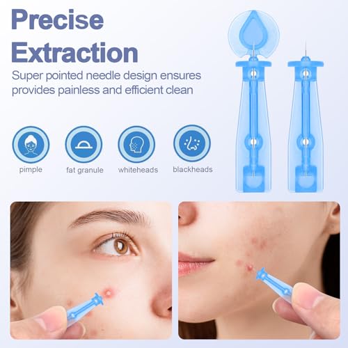 50 Pack Disposable Acne Pimple Popper Needles and 72 Dots Acne Pimple Stickers, for Acne Whitehead Acne Closed Mouth Clear Acne Needle (50 Pack) - Image 4