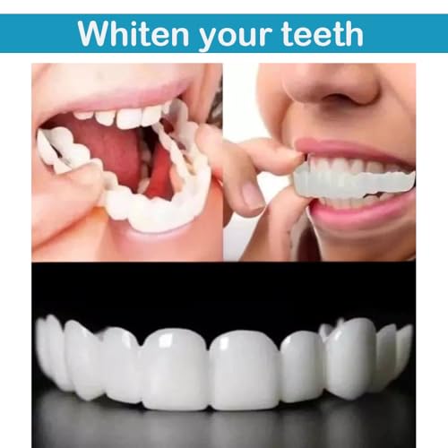 Image of Teeth Whitening - Teeth Restoration Kit, an Effective Solution to Cover Tooth Stains and Restore Teeth, Restoring Your Smile