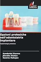 Opzioni protesiche nell'odontoiatria implantare (Italian Edition) 620242141X Book Cover