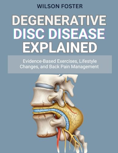 Degenerative Disc Disease Explained: Evidence-Based Exercises, Lifestyle Changes, and Back Pain...