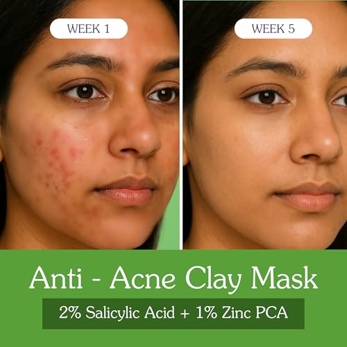Image of BAKE 2% Salicylic Acid Clay Mask Niacinamide for Acne Prone, Oily Skin, Open Pores & Blackheads | Anti Acne Clay Mask with Kaolin Clay | For Dark Spots, Oily Skin & Blemishes - 100g (Anti Acne)