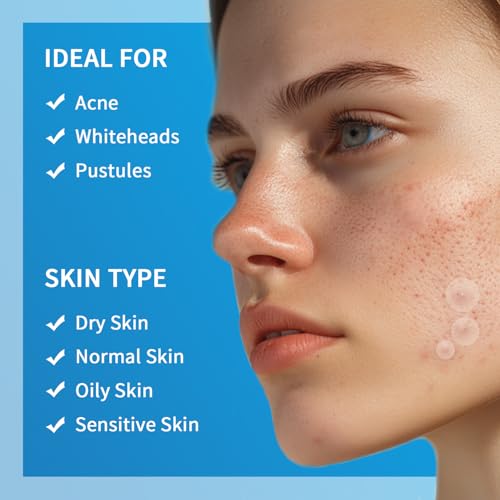 Pimple Patches for Face Hydrocolloid Acne Patches, Invisible Zit Stickers Covering Blemishes, 3 Size Hydrocolloid Spot Stickers for Face and Skin (144 Count(Pack of 1)) - Image 5