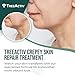 TreeActiv Crepey Skin Repair Cream, 8 oz, Firming Formula with Hyaluronic Acid & Shea Butter to Deeply Moisturize and Tighten Dry, Wrinkly Crepe Skin, 500+ Uses