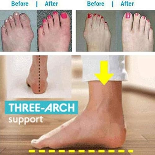 Yytcsjz Women's Large Size Fish Mouth Orthopedic Sandals, Open Toe Leather Flat Sole Sandal, Big Toe Bone Valgus Corrector Slippers With Arch Support3
