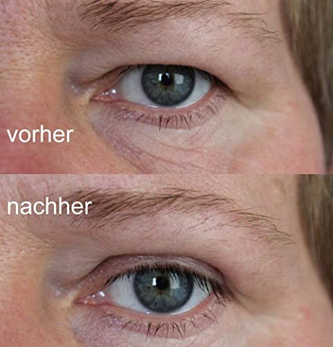Schlupflid Tape für Augenlider – Effektive Lösung ohne Operation