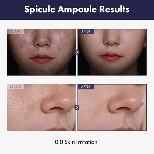 TOSOWOONG Real Spicule Ampoule with 30,000 Shots, Niacinamide, Panthenol, Liquid Skin Booster Serum, Korean Skincare, 30ml, 1.01 fl. oz. - Image 3
