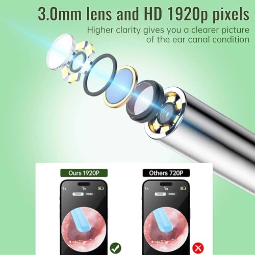 Image of Ear Cleaner Tool with Camera & LED Light, Ear Wax Removal Tool, Ear Cleaning Machine, Ear Cleaner with Camera, Ear Wax Cleaner Kit, HD Ear Camera Otoscope, Earwax Remover Tool for Adults & Kids