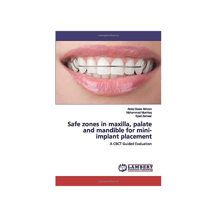 Buy Safe zones in maxilla, palate and mandible for miniimplant placement A CBCT Guided