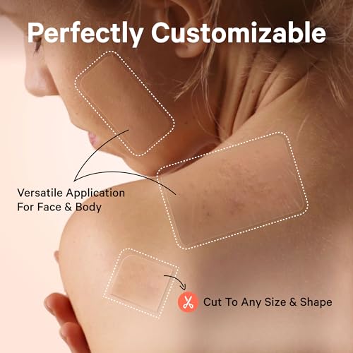 Image of Sosky Large Pimple Patches XL Hydrocolloid Acne Patches for Face & Body Cystic Pimple & Zit Patch for Nose Chin Back, Bacne & Breakouts Vegan Cruelty-Free（10 Count）