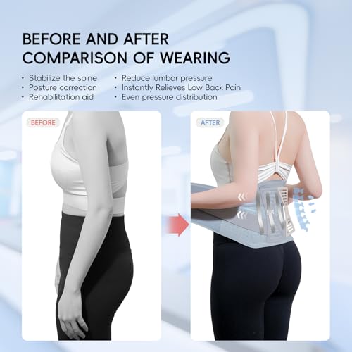 GOUNOD Adjustable Back Brace for Lower Back Pain for Women and Men, Removable Stays Back Support Brace for Herniated Disc, Scoliosis, and Sciatica Pain Relief - Ergonomic Design(Grey/S) — view 3