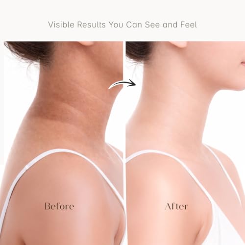 Image of Seoulskin Kojic & Rice Water Brightening Soap | Pack of 3 | Glowing & Brightening Soaps for bath | For Pigmentation, Dark Spots, Sun Damage | Tan Removal Soap Bar for men and women | Brightens Underarms | Paraben Free | All Skin Types | 3 X 100g