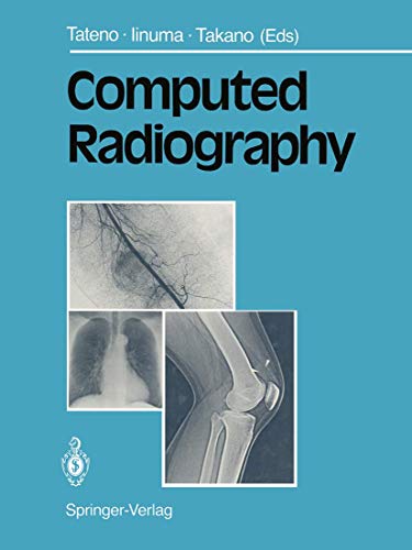 Computed Radiography view 2