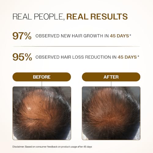 Image of Bare Anatomy Advanced Hair Growth Serum Roll-On| 3% Redensyl + 4% Anagain + 2% Baicapil + 5% Rosemary, Rice Water, Biotin & Saw Palmetto| Reduces Hair Fall, Supports Hair Growth for Men & Women | 25ml-Pack of 2