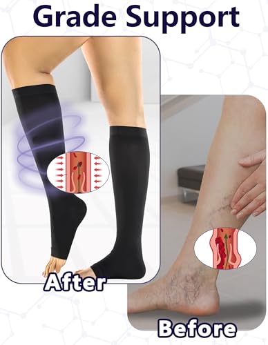 Image of +MD 2 Pairs 20-30 mmHg Compression Socks for Women & Men, Knee High Open Toe Stockings, Graduated Support & Comfort Hose
